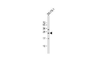 Anti-KLRF2 Antibody (N-term) at 1:1000 dilution + ZR-75-1 whole cell lysate Lysates/proteins at 20 μg per lane.