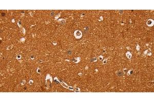 Immunohistochemistry of paraffin-embedded Human brain tissue using TNFRSF8 Polyclonal Antibody at dilution 1:60 (TNFRSF8 Antikörper)