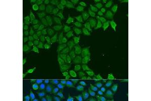 Immunofluorescence analysis of U2OS cells using CDK16 Polyclonal Antibody at dilution of 1:100. (CDK16 Antikörper)