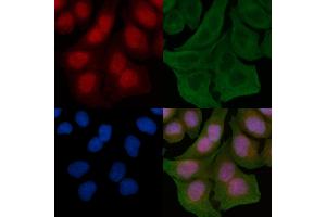 ABIN6259633 and ABIN6275638 staining Hela cells by IF/ICC. (GTF3A Antikörper  (N-Term))