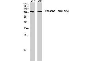 Western Blot (WB) analysis of VEC 293 lysis using Phospho-Tau (T205) antibody. (tau Antikörper  (pThr205))