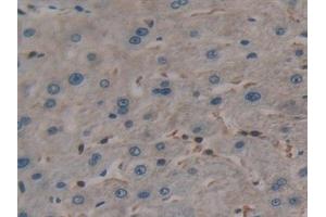 Immunohistochemistry (IHC) image for anti-Tumor Necrosis Factor (Ligand) Superfamily, Member 15 (TNFSF15) (AA 67-251) antibody (ABIN7442309)