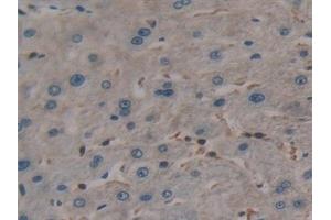 Detection of TL1A in Human Liver Tissue using Polyclonal Antibody to TNF Like Ligand 1A (TL1A) (TNF Like Ligand 1A (AA 67-251) Antikörper)