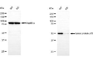 Western blotting analysis using tumor protein p53 antibody (ABIN7800685).