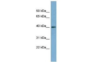 WB Suggested Anti-RP2 Antibody Titration: 0. (RP2 Antikörper  (Middle Region))
