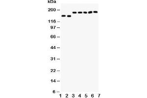 Western blot testing of DCC antibody and Lane 1:  rat brain;  2: mouse brain;  and human samples 3: U87;  4: SW620;  5: COLO320;  6: 293T;  7: HeLa cell lysate. (DCC Antikörper  (AA 162-178))