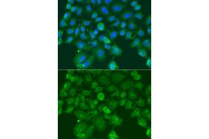 Immunofluorescence analysis of A549 cells using CST1 antibody (ABIN6293854). (CST1 Antikörper)