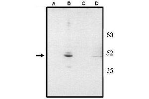 VSX2 Antikörper  (N-Term)