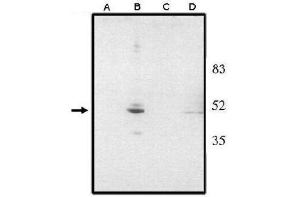 VSX2 Antikörper  (N-Term)