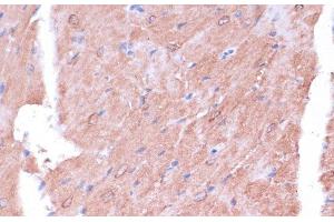 Immunohistochemistry (Paraffin-embedded Sections) (IHC (p)) image for anti-Translocase of Inner Mitochondrial Membrane 8 Homolog B (TIMM8B) antibody (ABIN7258706)