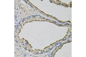 Immunohistochemistry of paraffin-embedded human prostate using LCN1 antibody  at dilution of 1:100 (40x lens). (Lipocalin 1 Antikörper  (AA 19-176))