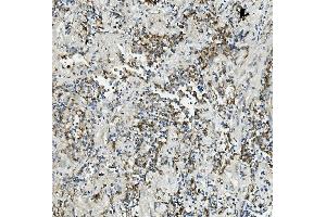 IHC analysis of Thioredoxin 2/TXN2 using anti-Thioredoxin 2/TXN2 antibody (ABIN7602149).