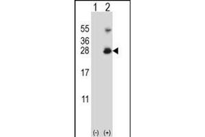 Western blot analysis of RNF11 (arrow) using rabbit polyclonal RNF11 Antibody (Center) (ABIN656832 and ABIN2846041). (RNF11 Antikörper  (AA 64-90))