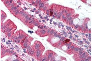 Human Small Intestine (formalin-fixed, paraffin-embedded) stained with TNFSF11 antibody ABIN214007 at 5 ug/ml followed by biotinylated goat anti-rabbit IgG secondary antibody ABIN481713, alkaline phosphatase-streptavidin and chromogen. (RANKL Antikörper  (Internal Region))