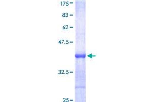 BTK Protein (AA 100-189) (GST tag)