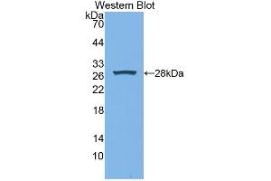 Western blot analysis of the recombinant protein. (XDH Antikörper  (AA 2-219))