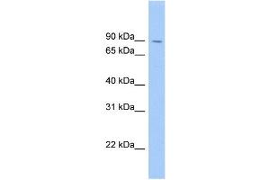 WB Suggested Anti-SATB1 Antibody Titration: 0.