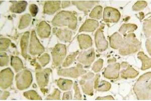 Immunohistochemistry (IHC) analyzes of Cytochrome b5 antibody in paraffin-embedded human heart tissue. (CYB5R3 Antikörper)