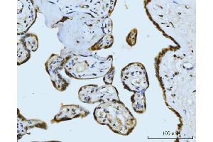IHC analysis of MRE11 using anti-MRE11 antibody (ABIN7600025). (Mre11 Antikörper  (AA 14-481))