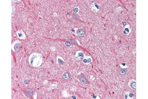 Anti-TUBB / Tubulin, Beta antibody IHC of human brain, cortex.