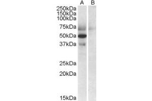 Image no. 1 for anti-Apolipoprotein L, 4 (APOL4) (C-Term) antibody (ABIN375002) (Apolipoprotein L 4 Antikörper  (C-Term))