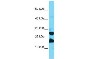 Host: Rabbit Target Name: A2LD1 Sample Type: Jurkat Whole Cell lysates Antibody Dilution: 1. (GGACT Antikörper  (N-Term))