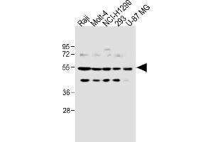All lanes : Anti-PFKFB4 Antibody (Center) at 1:1000 dilution Lane 1: Raji, whole cell lysate Lane 2: Molt-4 whole cell lysate Lane 3: NCI- whole cell lysate Lane 4: 293 whole cell lysate Lane 5: U-87 MG whole cell lysate Lysates/proteins at 20 μg per lane. (PFKFB4 Antikörper  (AA 266-296))