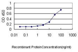 Detection limit for recombinant GST tagged RHOJ is approximately 1ng/ml as a capture antibody. (RHOJ Antikörper  (AA 1-214))