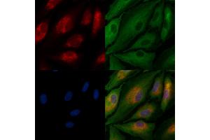ABIN7094526 and ABIN7098575 staining  cells by IF/ICC. (GFRA3 Antikörper  (Internal Region))