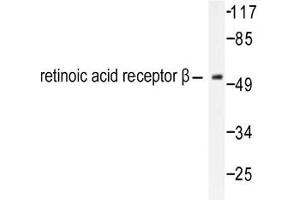 Image no. 1 for anti-Retinoic Acid Receptor, beta (RARB) antibody (ABIN271806) (Retinoic Acid Receptor beta Antikörper)