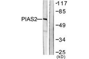 Western blot analysis of extracts from COS7 cells, using PIAS2 Antibody. (PIAS2 Antikörper  (AA 10-59))