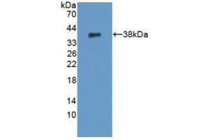 Detection of Recombinant PADI6, Human using Polyclonal Antibody to Peptidyl Arginine Deiminase Type VI (PADI6) (PADI6 Antikörper  (AA 393-694))