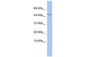 P2RX5 antibody used at 1 ug/ml to detect target protein.