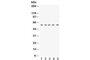 Western blot testing of human 1) HUT, 2) Jurkat, 3) Raji, 4) CEM and 5) K562 cell lysate with LCK antibody.
