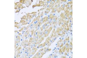 Immunohistochemistry of paraffin-embedded mouse heart using IL18BP antibody (ABIN5973845) at dilution of 1/100 (40x lens). (IL18BP Antikörper)