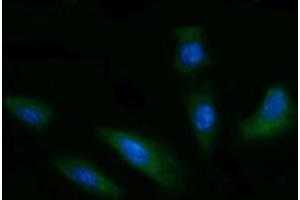 Immunofluorescence (IF) image for anti-T-cell surface glycoprotein CD1c (CD1C) antibody (ABIN2670669) (CD1c Antikörper)