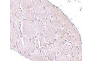 Immunohistochemistry of Wnt10a in human skeletal muscle tissue cells with this product at 10 μg/ml. (WNT10A Antikörper  (C-Term))