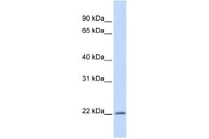 WB Suggested Anti-IFNA5 Antibody Titration: 0. (IFNA5 Antikörper  (Middle Region))