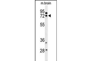 Western blot analysis of HSA Antibody (Center) (ABIN653722 and ABIN2843031) in mouse brain tissue lysates (35 μg/lane). (HSPA12A Antikörper  (AA 398-427))
