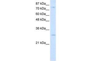 Western Blotting (WB) image for anti-RNA Binding Motif Protein 28 (RBM28) antibody (ABIN2462278) (RBM28 Antikörper)