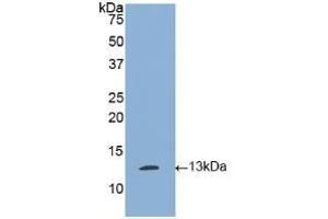 Detection of Recombinant tPA, Human using Polyclonal Antibody to Tissue Plasminogen Activator (tPA) (PLAT Antikörper)