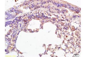 Formalin-fixed and paraffin embedded mouse lung labeled with Anti-MICA/MHC I a Polyclonal Antibody, Unconjugated (ABIN728788) at 1:200 followed by conjugation to the secondary antibody and DAB staining. (MICA Antikörper  (AA 120-170))