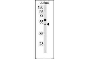 Western blot analysis of GNAT1 Antibody (C-term) in Jurkat cell line lysates (35ug/lane). (GNAT1 Antikörper  (C-Term))
