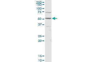 CDC14B polyclonal antibody (A01), Lot # 06046. (CDC14B Antikörper  (AA 360-459))