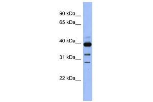 WB Suggested Anti-GNAO1 Antibody Titration: 0. (GNAO1 Antikörper  (N-Term))