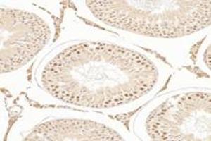 Immunohistochemistry (Paraffin-embedded Sections) (IHC (p)) image for anti-T-Box 19 (TBX19) antibody (ABIN7075815)