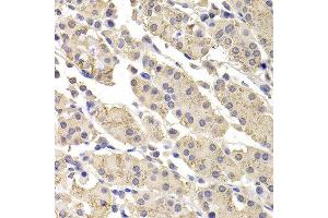 Immunohistochemistry of paraffin-embedded human stomach using DFFA antibody at dilution of 1:100 (x400 lens). (DFFA Antikörper)