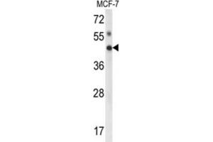 Western Blotting (WB) image for anti-Inositol Polyphosphate Multikinase (IPMK) antibody (ABIN3003997)