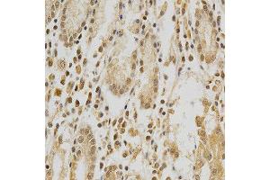 Immunohistochemistry of paraffin-embedded human stomach using HDAC6 antibody at dilution of 1:200 (x400 lens) (HDAC6 Antikörper  (AA 1-200))