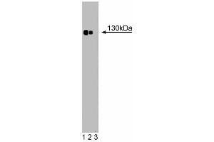 Western blot analysis of Phospholipase Cbeta4 on a rat pituitary lysate (left). (Phospholipase C beta 4 Antikörper  (AA 752-961))